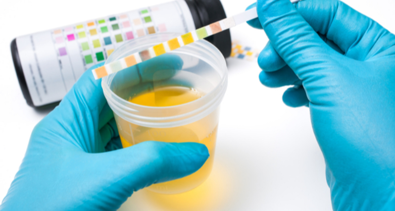 The Importance of Urine Tests for Diabetic Patients