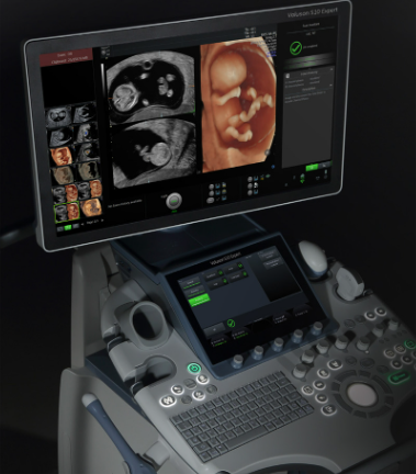 Introducing the Voluson S10 Expert Women’s Health Ultrasound Machine at Shree Diagnostics – A First in Howrah