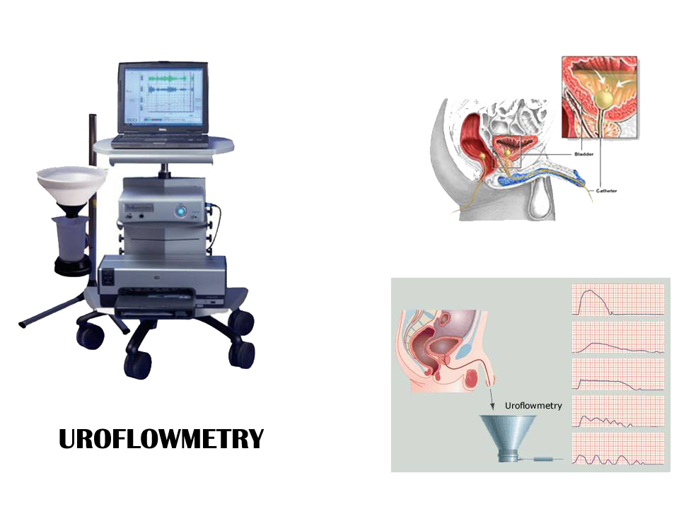 Uroflowmetry Test in Howrah: A Comprehensive Guide by Shree Diagnostics Centre & Clinic