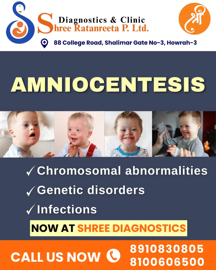 amniocentesis