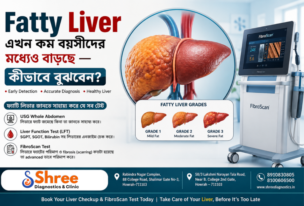 fatty liver (1)